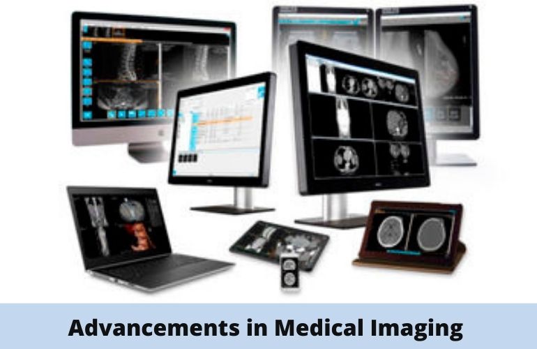 public/uploads/2021/04/Advancements-in-Medical-Imaging.jpg