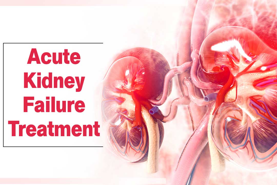 public/uploads/2021/12/Acute-Kidney-Failure-treatment.jpg