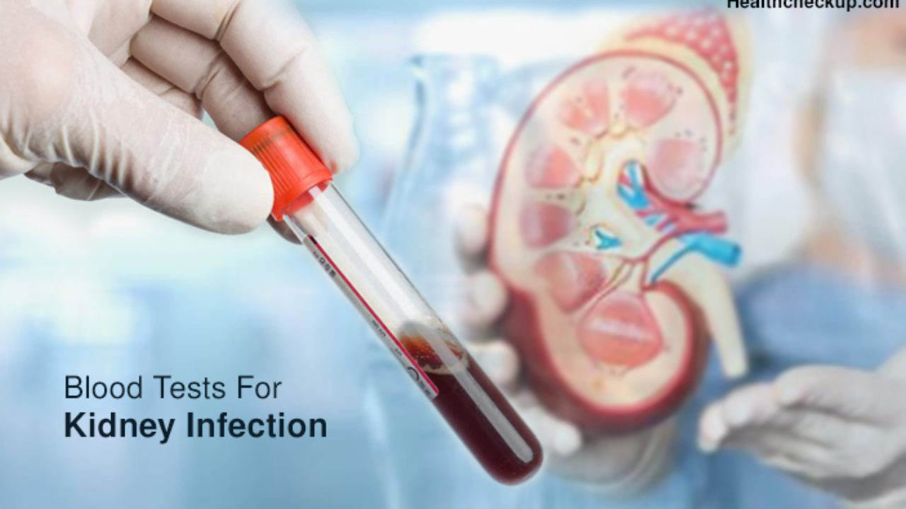 public/uploads/2021/12/Blood-tests-for-kidney-infection-1280x720-1.jpg