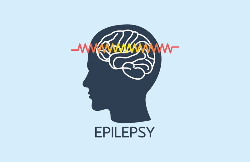 public/uploads/2022/01/epilepsy-main-blue.jpg