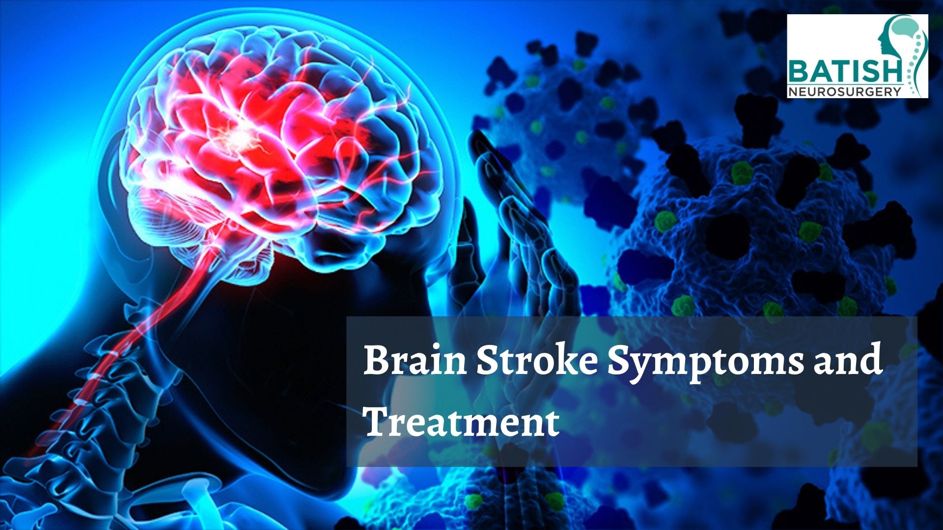 public/uploads/2022/04/Brain-Stroke-Symptoms-and-Treatment.jpg