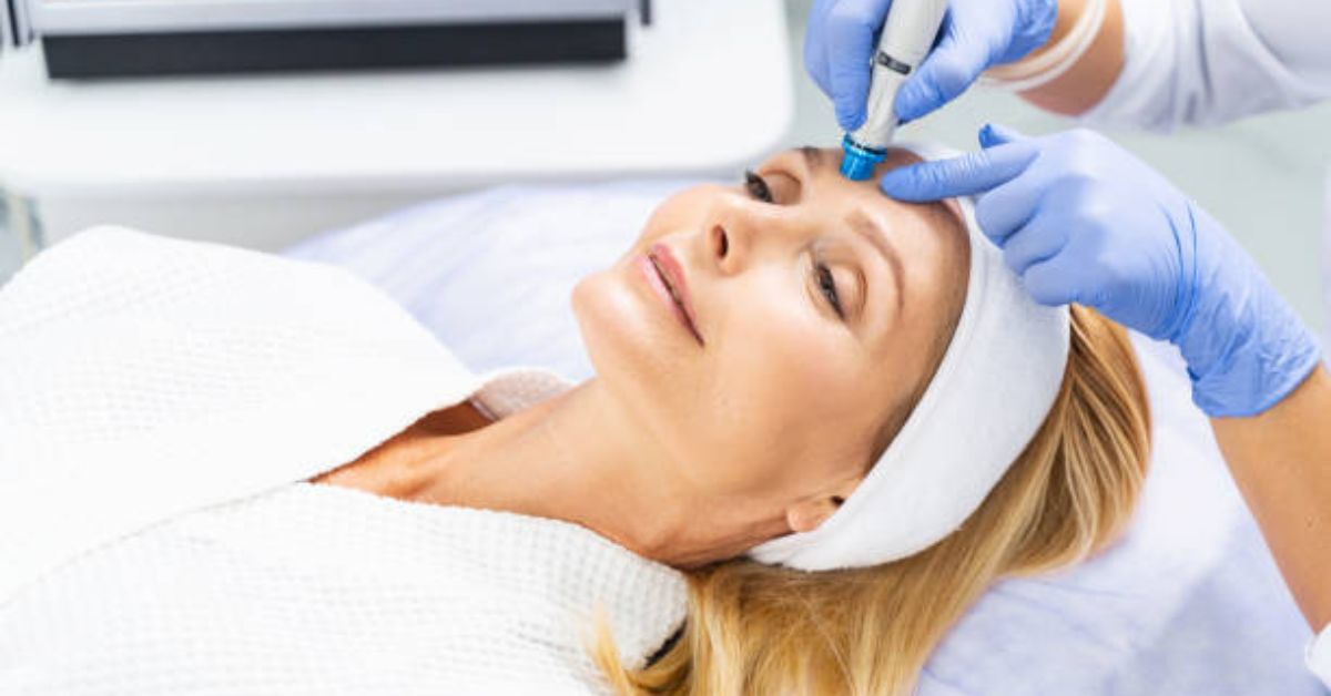 public/uploads/2022/08/Microdermabrasion.jpg